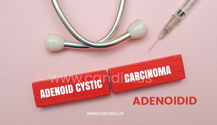 Adenoidid: Symptoms, Causes, Treatment & Complete Care Guide